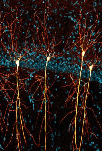 Neurone im Hippocampus transgener Mäuse - (c) Anna Karpova/ LIN